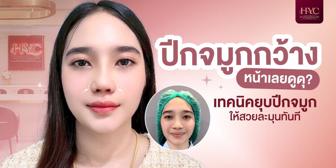 ปีกจมูกกว้าง หน้าเลยดูดุ?