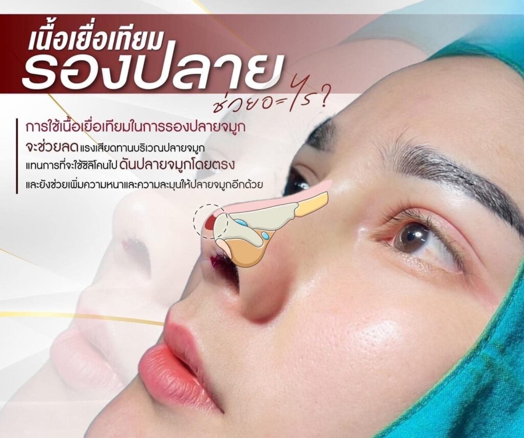 รองปลายเนื้อเยื่อเทียม-review