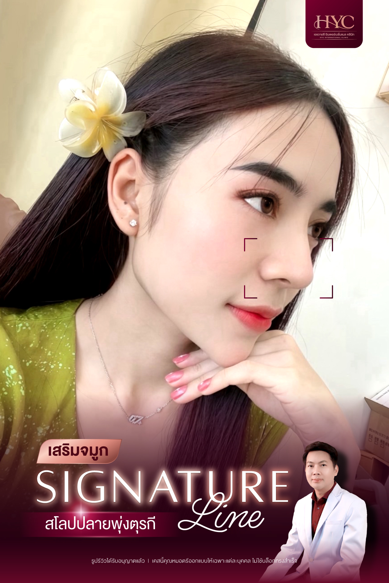 Aug2025-11-SignatureLine-สโลปปลายพุ่งตุรกี