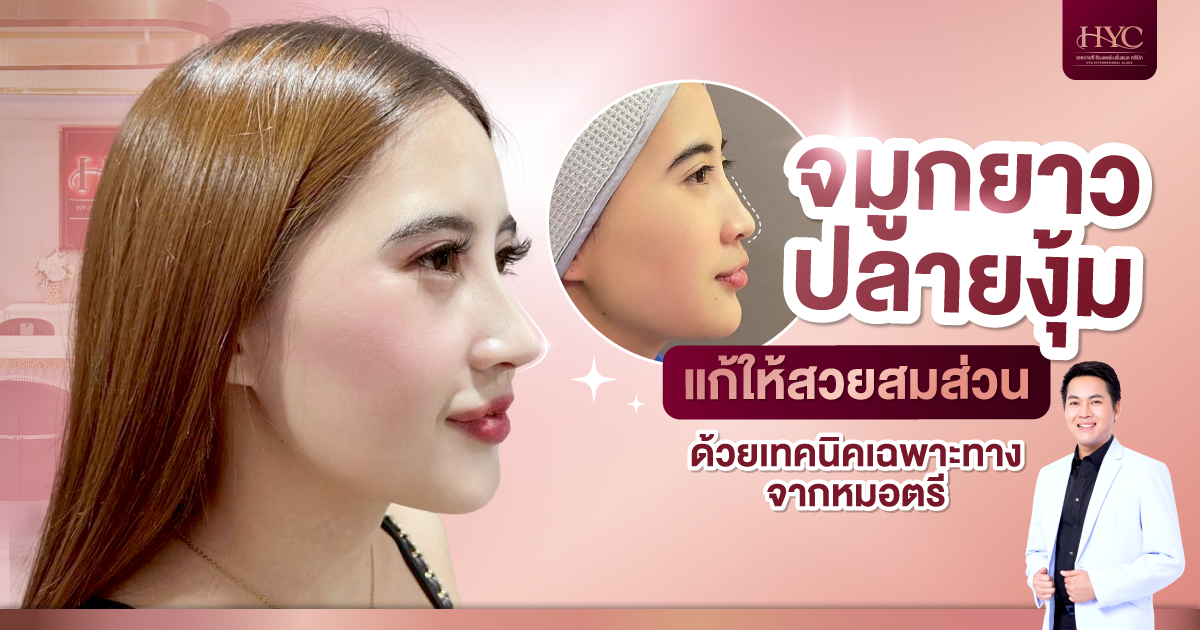 จมูกยาวปลายงุ้ม