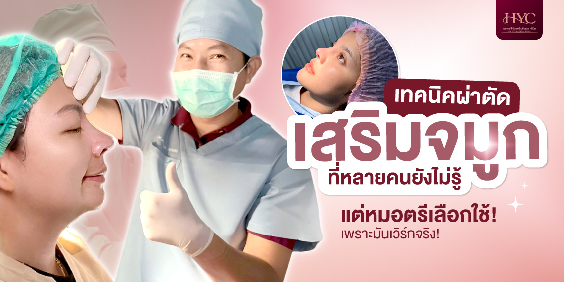 Rhinoplasty Surgery Techniques