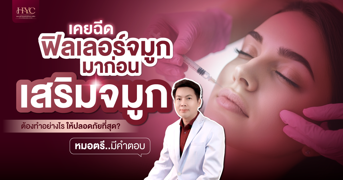 Have had nose filler injections before